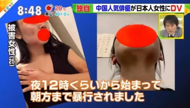 ձYŷl(f)ҕd@ӻؑ(yng)