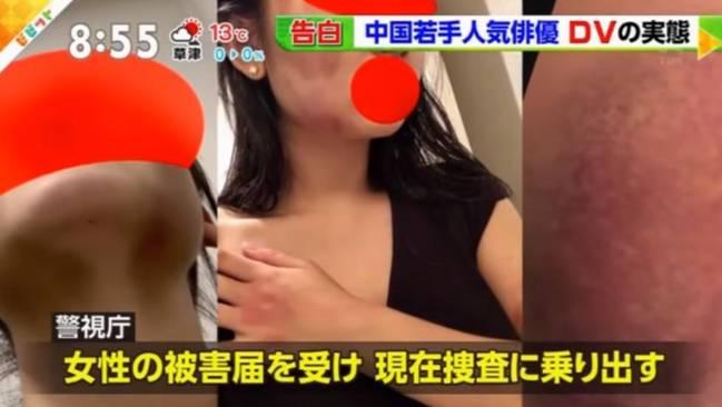 ձYŷl(f)ҕd@ӻؑ(yng)