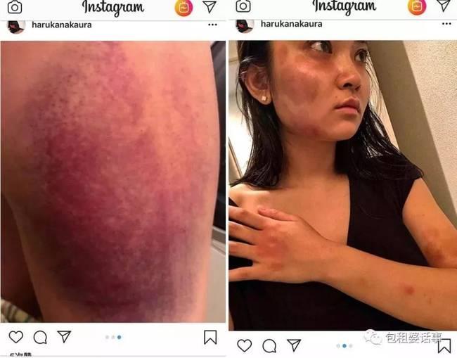 ձYŷl(f)ҕd@ӻؑ(yng)